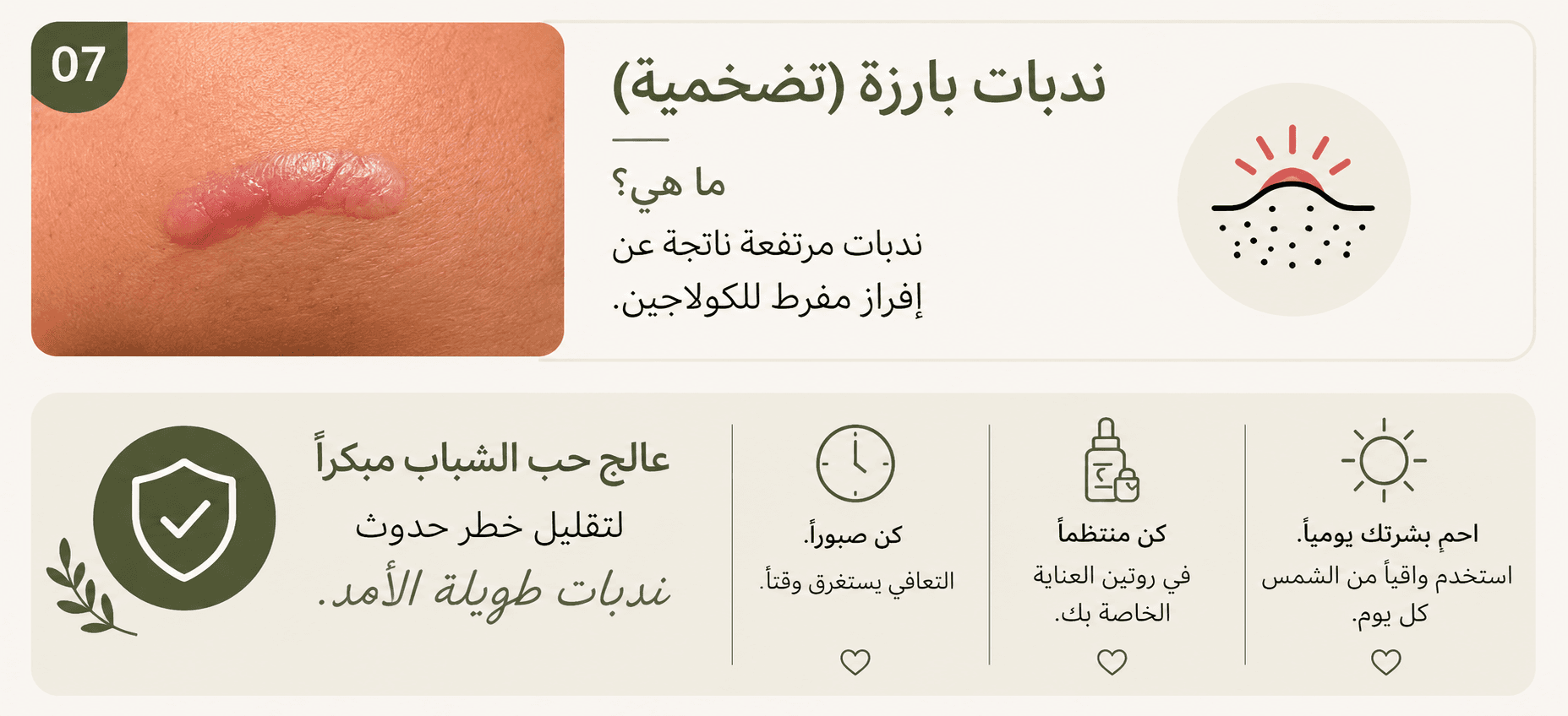 ندبات-حب-الشباب-البارزة-وعلاج-حب-الشباب-مبكرا.png