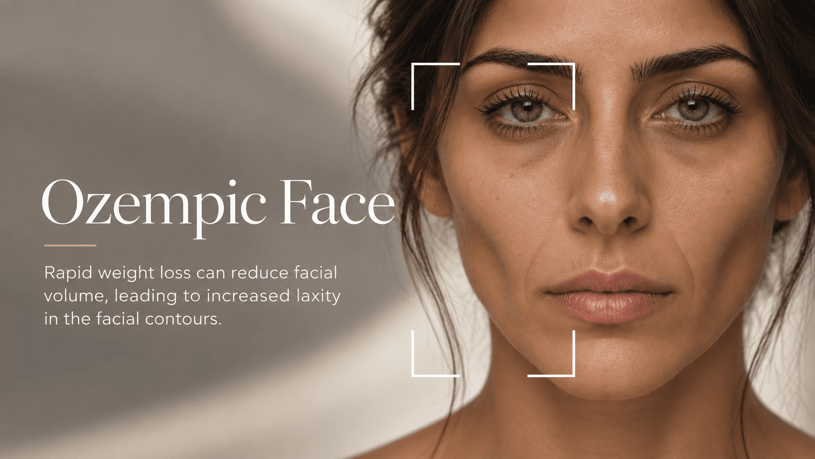 Ozempic face showing facial volume loss and skin laxity after significant weight loss